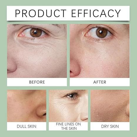 Noni Fruit Essence Moisturizes And Hydrates The Skin - souqmart