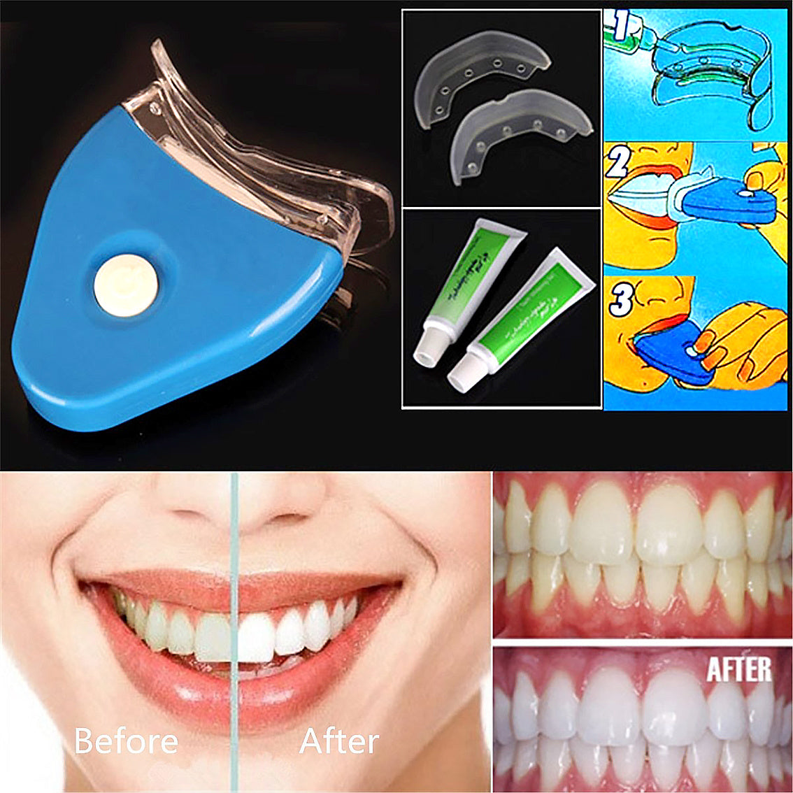 Oral Gel Teeth Tooth Whitening Whitener Dental Bleaching LED - souqmart